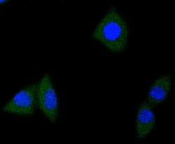 Invitrogen TrkA/TrkB/TrkC Recombinant Rabbit Monoclonal Antibody (JJ084-04)