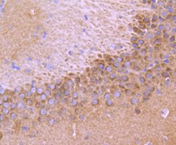 Invitrogen TrkA/TrkB/TrkC Recombinant Rabbit Monoclonal Antibody (JJ084-04)
