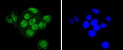 Invitrogen SUMO2/SUMO3 Recombinant Rabbit Monoclonal Antibody (JJ087-04)