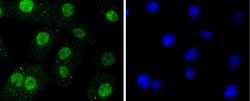 Invitrogen SUMO2/SUMO3 Recombinant Rabbit Monoclonal Antibody (JJ087-04)