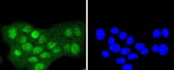 Invitrogen SUMO2/SUMO3 Recombinant Rabbit Monoclonal Antibody (JJ087-04)