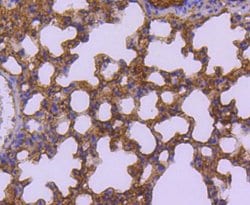 Invitrogen SUMO2/SUMO3 Recombinant Rabbit Monoclonal Antibody (JJ087-04)