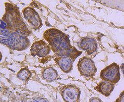 Invitrogen SUMO2/SUMO3 Recombinant Rabbit Monoclonal Antibody (JJ087-04)