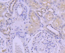 Invitrogen SUMO2/SUMO3 Recombinant Rabbit Monoclonal Antibody (JJ087-04)