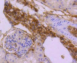 Invitrogen SUMO2/SUMO3 Recombinant Rabbit Monoclonal Antibody (JJ087-04)