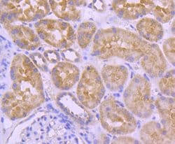 Invitrogen A-Raf Recombinant Rabbit Monoclonal Antibody (JJ08-68) 100 &mu;L;