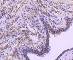 Invitrogen A-Raf Recombinant Rabbit Monoclonal Antibody (JJ08-68) 100 &mu;L;