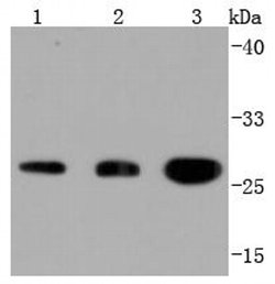 Invitrogen 14-3-3 beta/zeta Recombinant Rabbit Monoclonal Antibody (JJ083-6) 100 &mu;L | Buy Online | Invitrogen&trade; | Fisher Scientific
