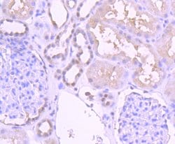 Invitrogen PAX2 Recombinant Rabbit Monoclonal Antibody (JJ082-08) 100 &mu;L;