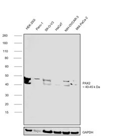 Invitrogen PAX2 Recombinant Rabbit Monoclonal Antibody (JJ082-08) 100 &mu;L;