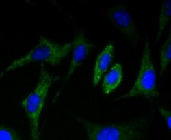 Invitrogen CD36 Recombinant Rabbit Monoclonal Antibody (JJ2005) 100 &mu;L | Buy Online | Invitrogen&trade; | Fisher Scientific