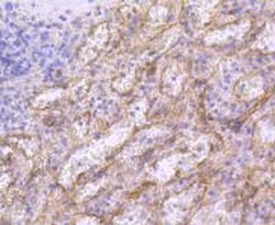 Invitrogen CD36 Recombinant Rabbit Monoclonal Antibody (JJ2005) 100 &mu;L | Buy Online | Invitrogen&trade; | Fisher Scientific