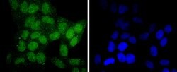 Invitrogen SIRT6 Recombinant Rabbit Monoclonal Antibody (JJ20-69) 100 &mu;L;