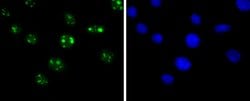 Invitrogen SIRT6 Recombinant Rabbit Monoclonal Antibody (JJ20-69) 100 &mu;L;