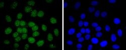 Invitrogen Phospho-c-Jun (Thr91) Recombinant Rabbit Monoclonal Antibody