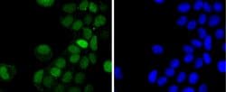 Invitrogen Phospho-c-Jun (Thr91) Recombinant Rabbit Monoclonal Antibody