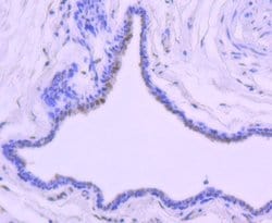 Invitrogen Phospho-c-Jun (Thr91) Recombinant Rabbit Monoclonal Antibody