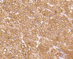 Invitrogen GLUT2 Recombinant Rabbit Monoclonal Antibody (JJ20-21) 100 &mu;L;