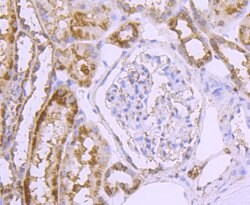 Invitrogen GLUT2 Recombinant Rabbit Monoclonal Antibody (JJ20-21) 100 &mu;L;