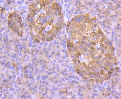 Invitrogen GLUT2 Recombinant Rabbit Monoclonal Antibody (JJ20-21) 100 &mu;L;