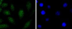 Invitrogen&trade;&nbsp;SOX1 Recombinant Rabbit Monoclonal Antibody (JJ20-40)