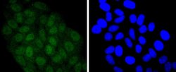 Invitrogen STAT5 alpha/beta Recombinant Rabbit Monoclonal Antibody (JJ08-78) 100 &mu;L | Buy Online | Invitrogen&trade; | Fisher Scientific