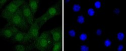 Invitrogen STAT5 alpha/beta Recombinant Rabbit Monoclonal Antibody (JJ08-78) 100 &mu;L | Buy Online | Invitrogen&trade; | Fisher Scientific