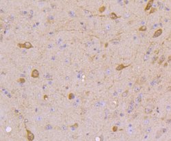 Invitrogen STAT5 alpha/beta Recombinant Rabbit Monoclonal Antibody (JJ08-78) 100 &mu;L | Buy Online | Invitrogen&trade; | Fisher Scientific
