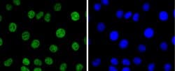 Invitrogen PAX8 Recombinant Rabbit Monoclonal Antibody (JJ08-88) 100 &mu;L;