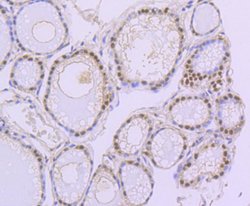 Invitrogen PAX8 Recombinant Rabbit Monoclonal Antibody (JJ08-88) 100 &mu;L;