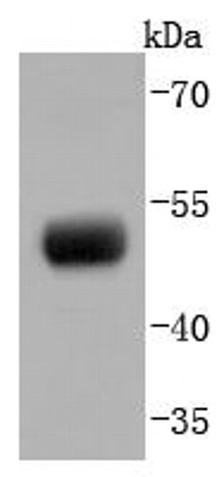 Invitrogen PAX8 Recombinant Rabbit Monoclonal Antibody (JJ08-88) 100 &mu;L;