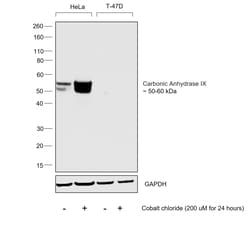 Invitrogen Carbonic Anhydrase IX Recombinant Rabbit Monoclonal Antibody (JJ088-9) 100 &mu;L | Buy Online | Invitrogen&trade; | Fisher Scientific