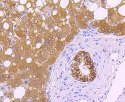 Invitrogen Carbonic Anhydrase IX Recombinant Rabbit Monoclonal Antibody