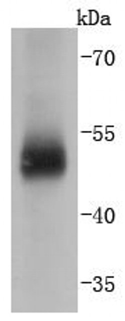 Invitrogen Carbonic Anhydrase IX Recombinant Rabbit Monoclonal Antibody