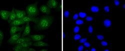 Invitrogen Caspase 14 Recombinant Rabbit Monoclonal Antibody (JJ089-01)