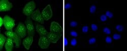 Invitrogen Caspase 14 Recombinant Rabbit Monoclonal Antibody (JJ089-01)