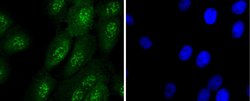 Invitrogen Caspase 14 Recombinant Rabbit Monoclonal Antibody (JJ089-01)