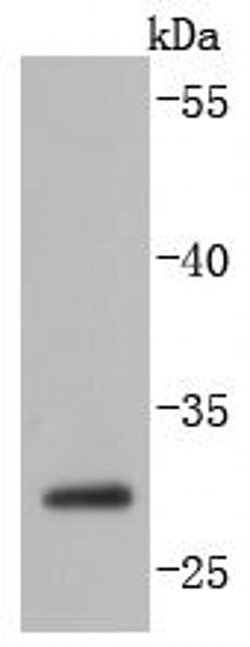 Invitrogen Caspase 14 Recombinant Rabbit Monoclonal Antibody (JJ089-01)