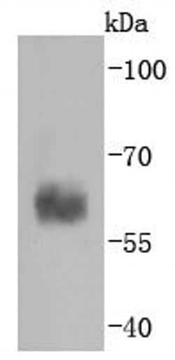 Invitrogen Caspase 10 Recombinant Rabbit Monoclonal Antibody (JJ0890) 100