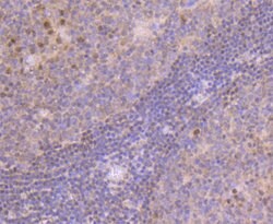 Invitrogen MGMT Recombinant Rabbit Monoclonal Antibody (JJ089-6) 100 &mu;L | Buy Online | Invitrogen&trade; | Fisher Scientific