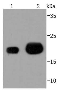 Invitrogen MGMT Recombinant Rabbit Monoclonal Antibody (JJ089-6) 100 &mu;L | Buy Online | Invitrogen&trade; | Fisher Scientific