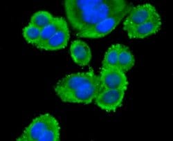 Invitrogen CD3d Recombinant Rabbit Monoclonal Antibody (JJ08-97) 100 &mu;L;