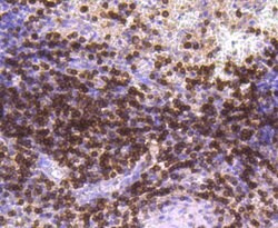 Invitrogen CD3d Recombinant Rabbit Monoclonal Antibody (JJ08-97) 100 &mu;L;