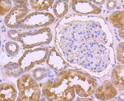 Invitrogen CD3d Recombinant Rabbit Monoclonal Antibody (JJ08-97) 100 &mu;L;