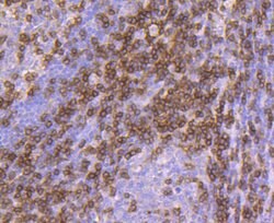 Invitrogen CD3d Recombinant Rabbit Monoclonal Antibody (JJ08-97) 100 &mu;L;