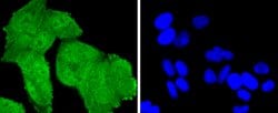Invitrogen TSG101 Recombinant Rabbit Monoclonal Antibody (JJ0900) 100 &mu;L;