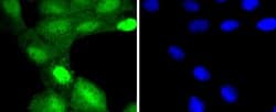 Invitrogen TSG101 Recombinant Rabbit Monoclonal Antibody (JJ0900) 100 &mu;L;