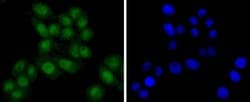Invitrogen TSG101 Recombinant Rabbit Monoclonal Antibody (JJ0900) 100 &mu;L;