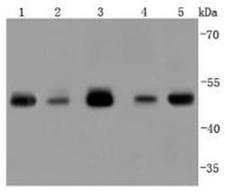 Invitrogen TSG101 Recombinant Rabbit Monoclonal Antibody (JJ0900) 100 &mu;L;
