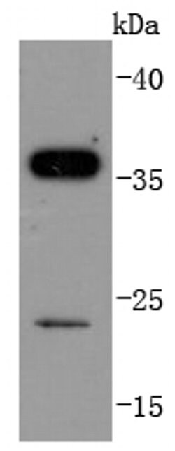 Invitrogen SIRT5 Recombinant Rabbit Monoclonal Antibody (JJ084-01) 100